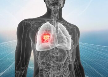 Un ensayo liderado por el Hospital Puerta de Hierro ofrece resultados esperanzadores al reducir recaídas en cáncer de pulmón