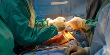 Más de 8 millones de euros invierte la Comunidad de Madrid en material para reparar válvulas cardíacas sin necesidad de cirugía abierta