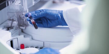 120 millones de euros de inversión en la mejora de los servicios del Laboratorio Clínico Central que atiende a seis hospitales públicos